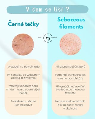 ✨ ČERNÉ TEČKY VS. SEBACEOUS FILAMENTS ✨ Ne všechno, co vidíte v pórech, jsou černé tečky ☝️ Černé tečky vznikají ucpáním...